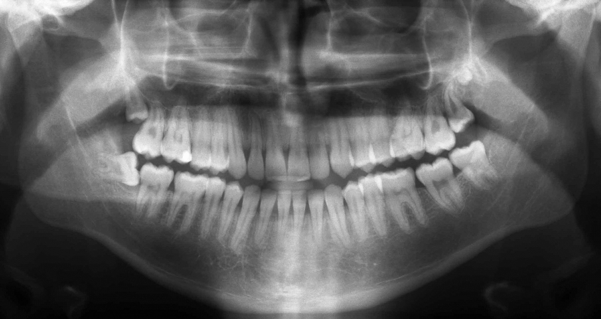 Digitisation of Radiography 