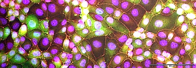 Triple staining rotavirus infected cells