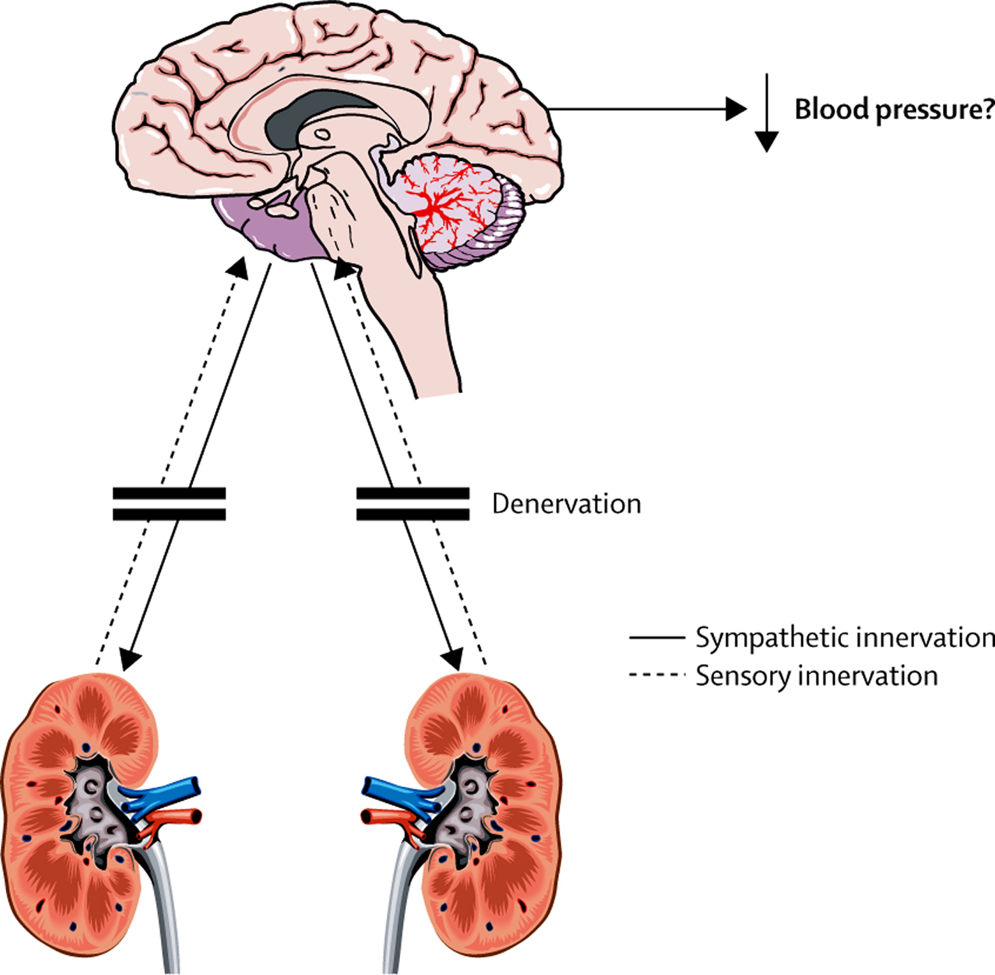 This is an article published in Lancet by Professor Edward Johns of the Physiology Department