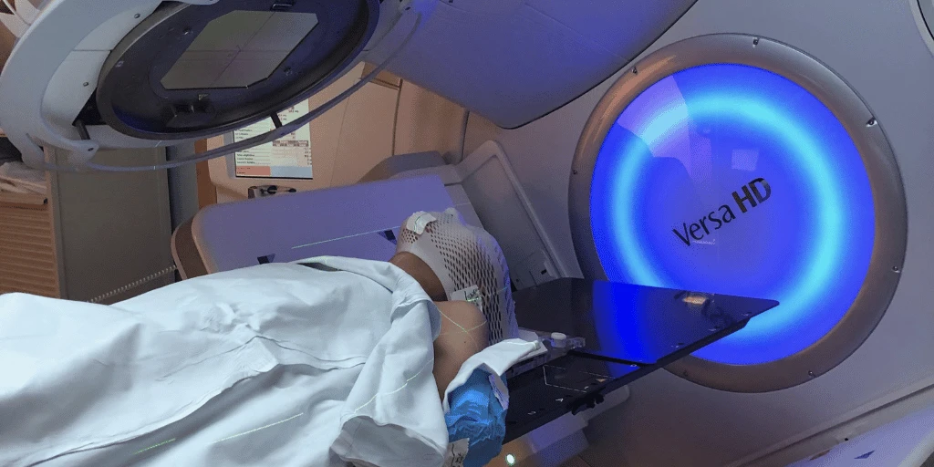 Radiation Therapy: Frequently Asked Questions