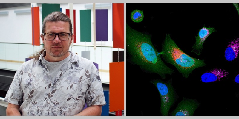 Left: Prof Pasha Baranov, UCC. Right: Cancer cell expressing microprotein (colored in red). Credit: Ting Luo/Princess Máxima Center for pediatric oncology.